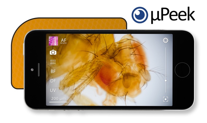 uPeek iPhone based Microscope